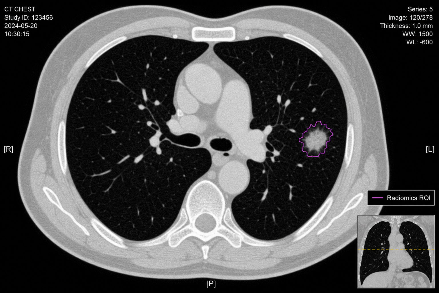 Multi-Site Imaging Harmonization Study