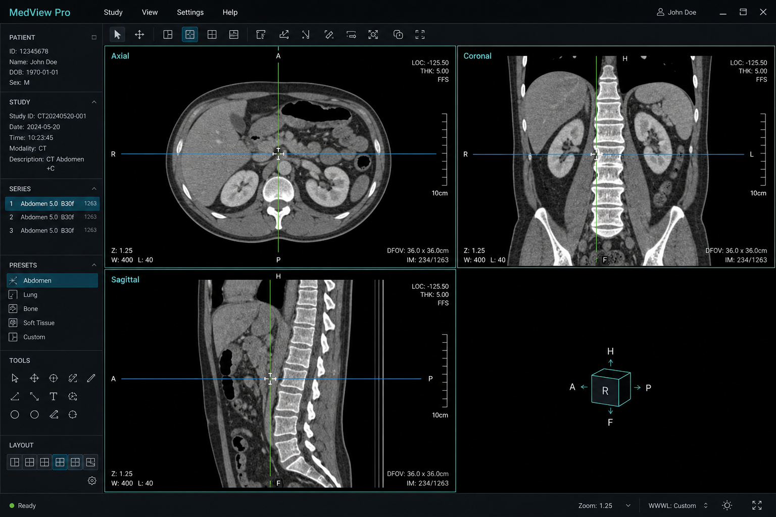Medical Image Visualization